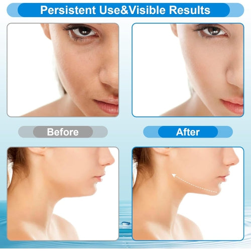 Anti Ageing Skin Lifting Device